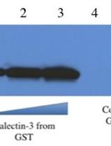 Preparation of Recombinant Galectin-3 for Cancer Studies