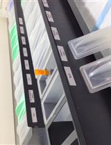 神经元细胞死亡的Fluoro-Jade B染色