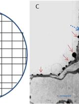 Cytohistochemical Determination of Calcium Deposition in Plant Cells