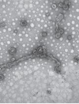Preparation of Outer Membrane Vesicles from Myxococcus xanthus