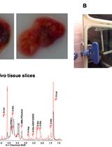 体外组织切片的稳定同位素分解代谢组学研究