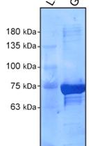 RAB21 Activity Assay Using GST-fused APPL1