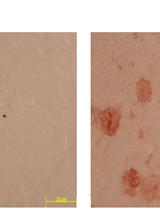 Quantification of Rae-1 Staining Intensity in Glomeruli