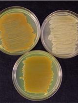 Testing the Effect of UV Radiation on the Survival of Burkholderia glumae