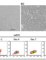 Isolation and Culture of Human CD133+ Non-adherent Endothelial Forming Cells
