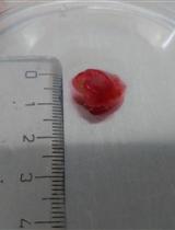 Colon Cancer-associated Fibroblast Establishment and Culture Growth