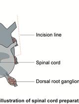 Isolation and Primary Cell Culture of Mouse Dorsal Root Ganglion Neurons