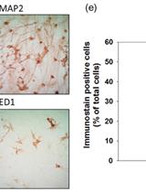 Primary Neuron-glia Culture from Rat Cortex as a Model to Study Neuroinflammation in CNS Injuries or Diseases