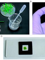 Measuring the Interactions between Peroxisomes and Chloroplasts by in situ Laser Analysis