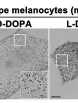 Visualization of Intracellular Tyrosinase Activity in vitro