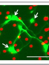 Phagocytosis Assay of Microglia for Dead Neurons in Primary Rat Brain Cell Cultures