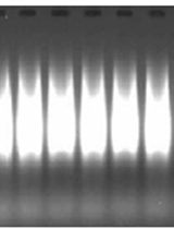 Affymetrix Genome-wide Human SNP Assay