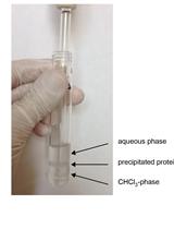 Extraction and Quantification of Sphingosine 1-Phosphate (S1P)
