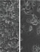 Preparation of Respiratory Syncytial Virus with High or Low Content of Defective Viral Particles and Their Purification from Viral Stocks