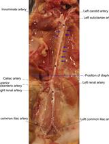 Preparation of Single Cell Suspensions from Mouse Aorta