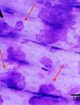 Pit Assay to Measure the Bone Resorptive Activity of Bone Marrow-derived Osteoclasts