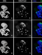 Cytology and Microscopy: Immunolocalization of Covalently Modified Histone Marks on Barley Mitotic Chromosomes