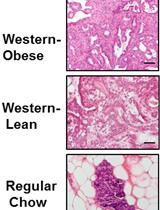 High Fat Diet-induced Breast Cancer Model in Rat