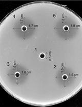 An Improved and Simplified Radial Gel Diffusion Assay for the Detection of Xylanase Activity