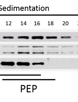 Investigating the Assembly Status of the Plastid Encoded Polymerase Using BN-PAGE and Sucrose Gradient Centrifugation 