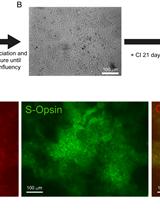 Differentiation of Human Embryonic Stem Cells into Cone Photoreceptors
