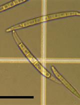 建立拟南芥叶片和花组织的禾谷镰刀菌感染模型