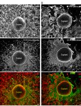 Mouse Subependymal Zone Explants Cultured on Primary Astrocytes 