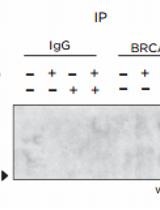 Ubiquitination Assay for Mammalian Cells 