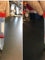 对疟原虫感染的红细胞进行示踪染色以观察免疫吞噬效应