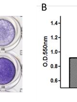 Bone Marrow Mesenchymal Stem Cells Adhesion Assay