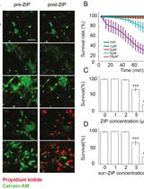 Acute Live/Dead Assay for the Analysis of Toxic Effects of Drugs on Cultured Neurons