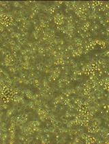 Bone Marrow-derived Endothelial Progenitor Cell Intercellular Adhesion Assay