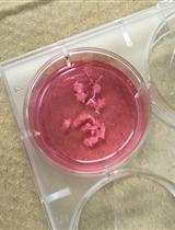 Isolation of Joint-infiltrating Cells