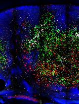 Imaging Thick Lymph Node Tissue Sections