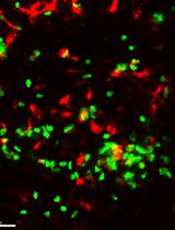 Skin TRITC Painting to Track Dendritic Cells Migrating to the Lymph Nodes