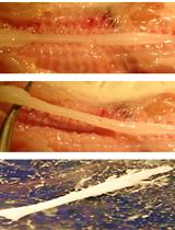 Organotypic Spinal Cord Slice Cultures and a Method to Detect  Cell Proliferation in These Slices 
