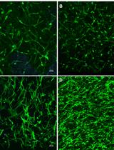 A 3D Culture System of Human Immortalized Myometrial Cells