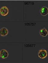 Quantification of Tumor Material Uptake