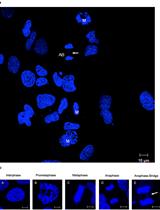 Detection of Anaphase Bridge Formation by Immunofluorescence  Microscopy in Mammalian Cells