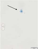 Sulforhodamine B (SRB) Assay in Cell Culture to Investigate Cell Proliferation