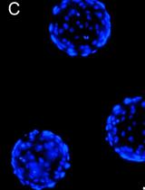 Evaluation of Angiogenesis Inhibitors Using the HUVEC Fibrin Bead Sprouting Assay