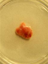 Isolation of Primary Breast Cancer Cells from HER2 Transgenic Mice