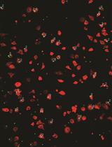 Microglial Phagocytosis Assay