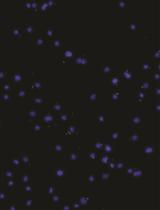 Protocol for Primary Microglial Culture Preparation