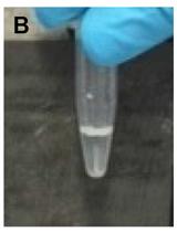 Determination of Rate of [3H-methyl]-choline Incorporation  into Cellular Lipids and Non-lipid Metabolites