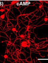 An in vitro Model of Neuron-macrophage Interaction to Generate  Macrophages with Neurite Outgrowth Properties