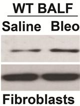 Assay to Evaluate BAL Fluid Regulation of Fibroblast α-SMA Expression