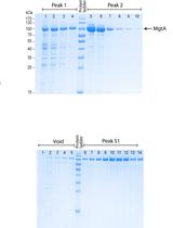 Heterologous Expression and Purification of the Magnesium Transporter A (MgtA) in Escherichia coli