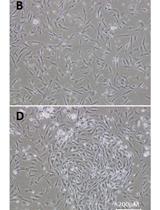 Isolation and Primary Culture of Various Cell Types from Whole Human Endometrial Biopsies