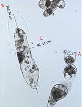 Isolating and Measuring the Growth and Morphology of Pro-embryogenic  Masses in Araucaria angustifolia (Bertol.) Kuntze (Araucariaceae)